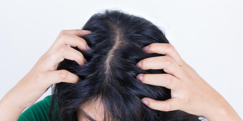 7-remedies-to-resolve-itchy-scalp-during-pregnancy